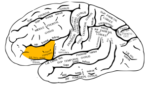 partie triangulaire du gyrus frontal inférieur